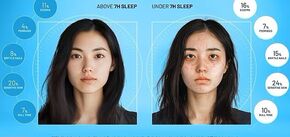 Brittle nails, bloated stomach, skin spots: AI shows what can happen to the body if you sleep less than 7 hours