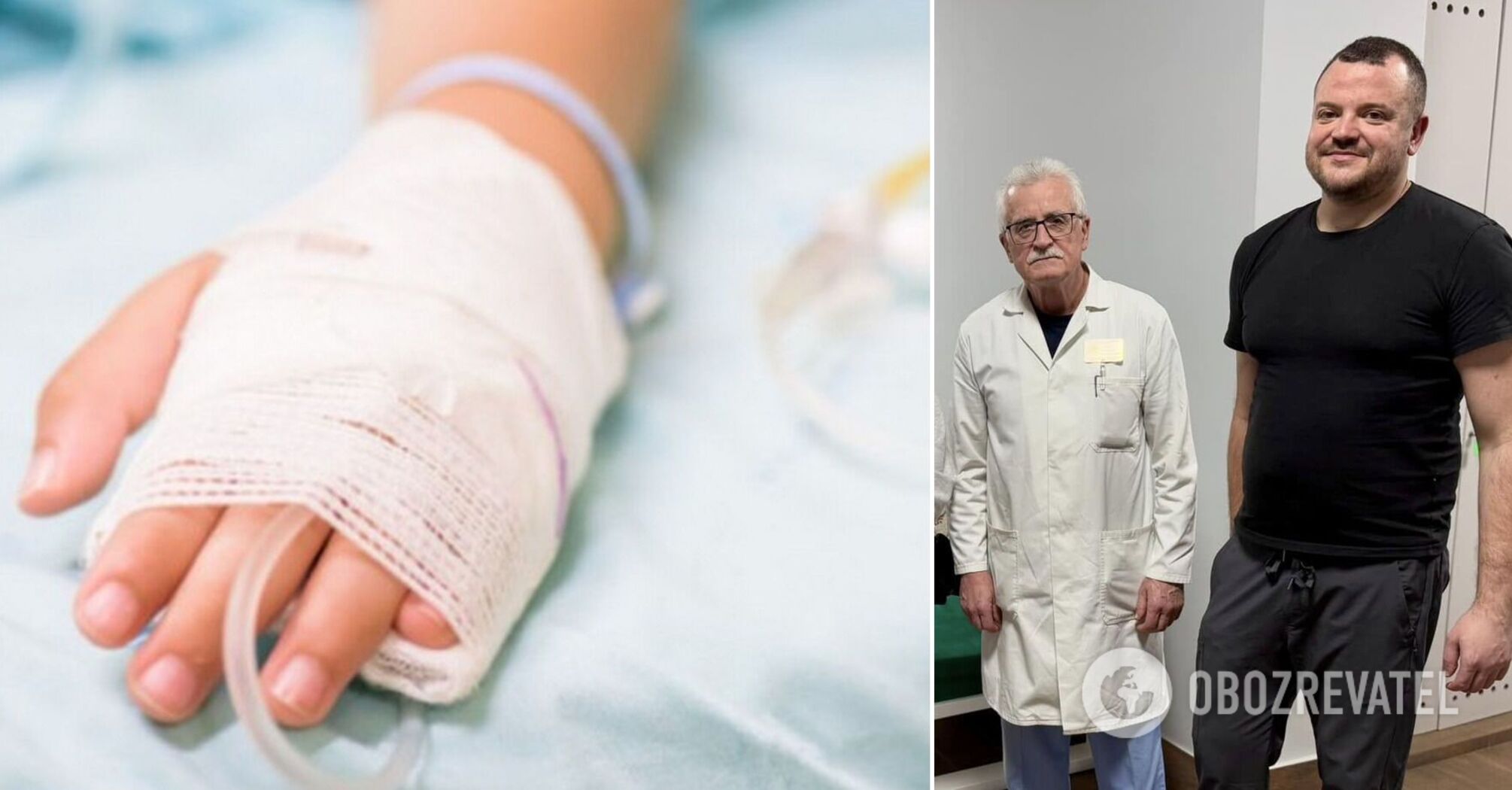 "Unique medical case": In Lviv, doctors removed a kilogram of hair from a 15-year-old girl's stomach. Photo