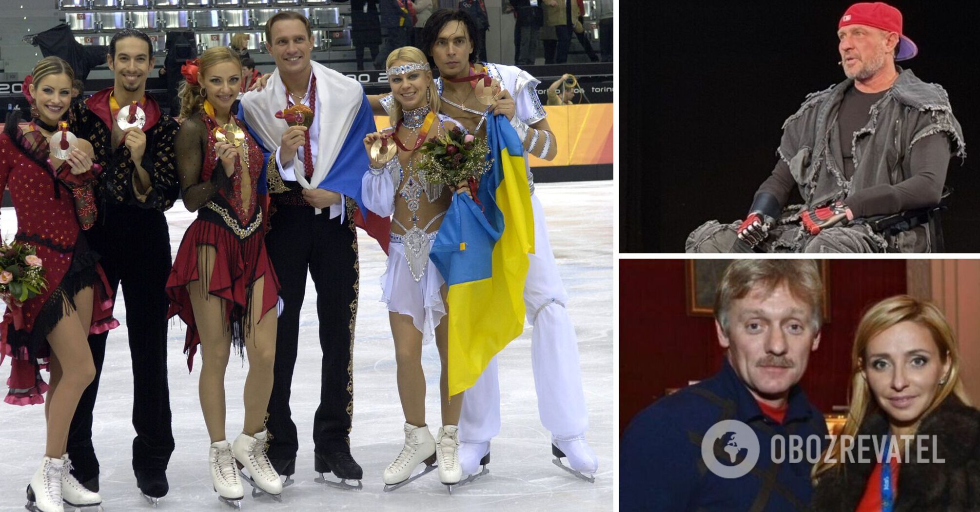 Olympic champion, who had his legs and arms amputated, told what Peskov's "Ukrainian" wife advised him