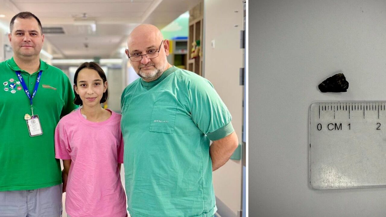 Осколок "Шахеда" пробил печень: в "Охматдете" спасли 12-летнюю девочку, пострадавшую в результате атаки РФ. Фото