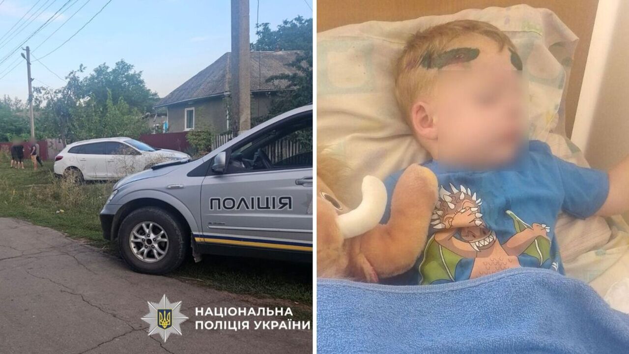 "Дитина була у крові": батько 2-річного хлопчика, на якого наїхав працівник ТЦК на Одещині, розповів, що сталося. Фото